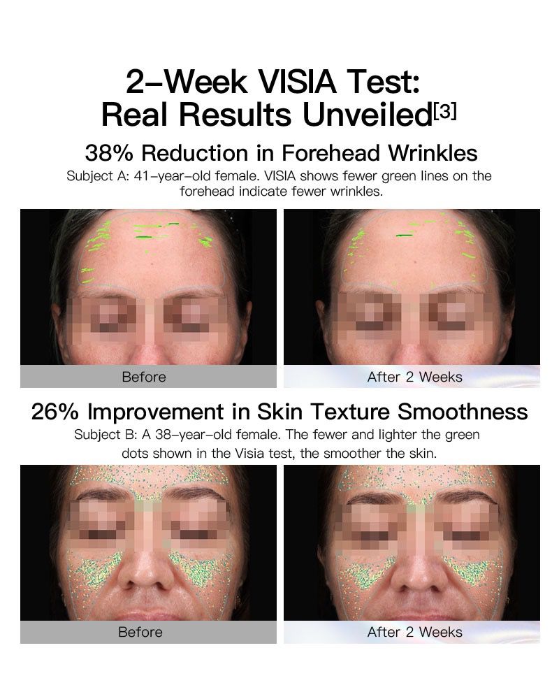 【Member Upgrade】Vida Glow Pro Collagen+*30 sachets/pack*4 + Anti-Aging/Ultra Bright Serum 1.2ml*7 Ampoules Free RM30 Voucher Pack